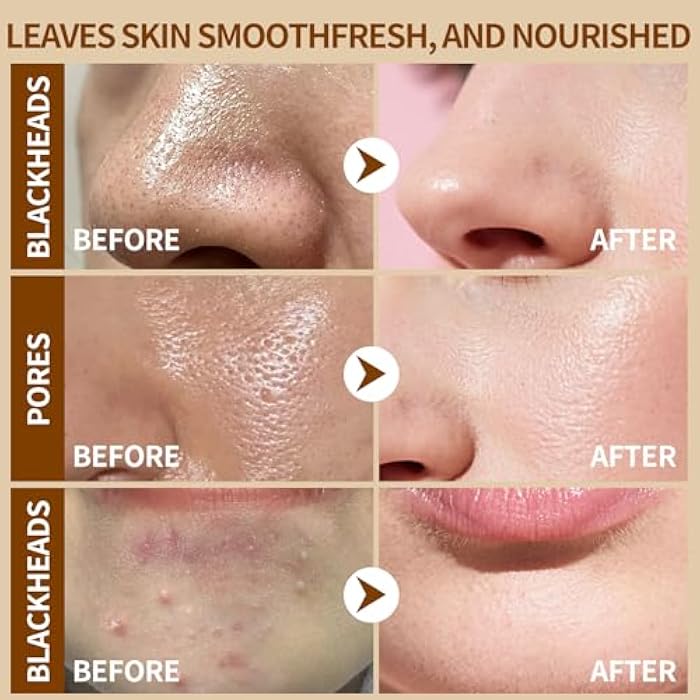 dewyhour Soybean Moisture Exfoliating Serum - Gentle Daily Soft-Exfoliating Face Peel for Dead Skin Cells Remover - For All Skin Types, Korean Skin Care 30ml / 1.01 fl.oz - Image 4
