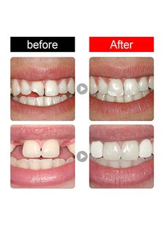 HaLunhi Dental Temporary Tooth Cap Crown Veneers Front Back Anterior and Molar Posterior Teeth with Tooth Repair Thermal Beads Cap Filler for Missing Broken Teeth (50 Pcs Front Teeth and 50 Pcs Back Teeth)  - Image 5