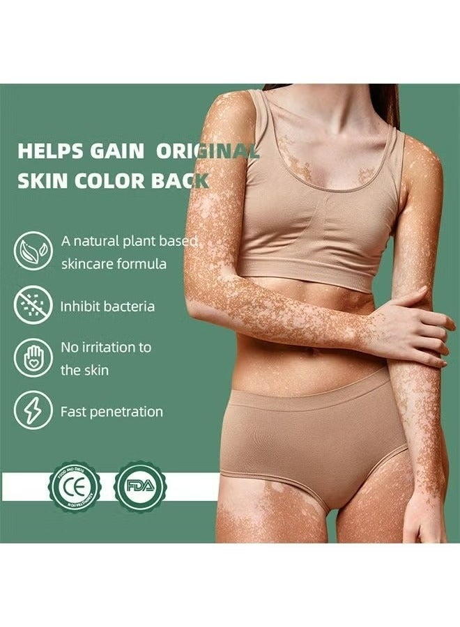 Sumifun Vitiligo Relief Cream 20G, Treatment for Skin Vitiligo Ointment, Fade White Spot and Improve Skin Pigmentation Cream, Vitiligo Cream for Skin Healthy Care - Image 3