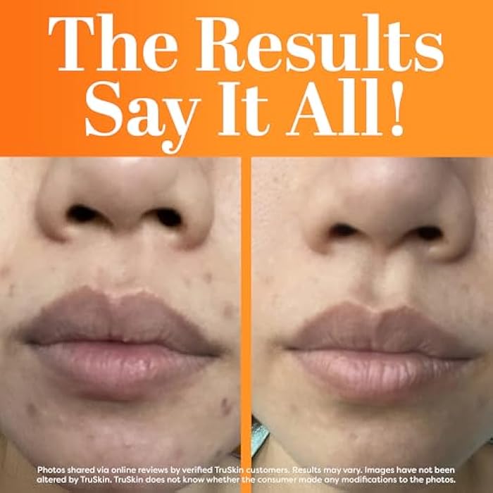 TruSkin Vitamin C Serum For Face – Anti Aging Face Serum with Vitamin C, Hyaluronic Acid, Vitamin E – Brightening Formula – Improve Appearance of Dark Spots, Tone, Fine Lines & Wrinkles, 1 Fl Oz - Image 4