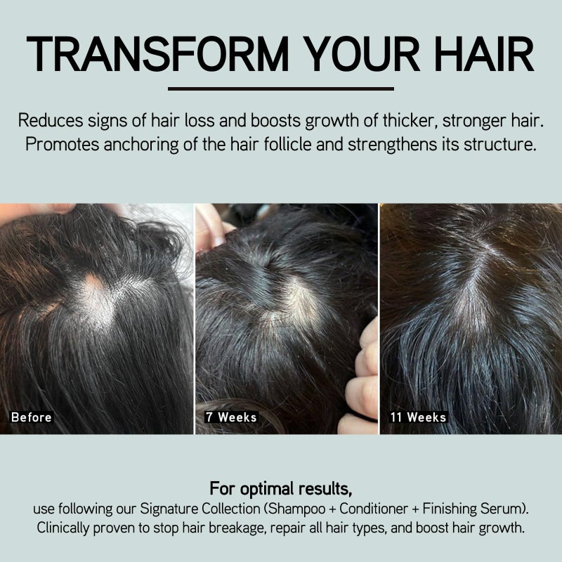 ILES FORMULA Scalp & Hair Rejuvenating Booster â€“ Reduces Hair Loss Signs, Boosts Growth & Thickness, Botanically Derived Breakthrough Blend with Procapil, Tomato, Apple & Wasabi Extracts (1.7 Fl Oz) - Image 3