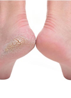 NIBEMINENT Pedicure File Green/Black  - Image 2