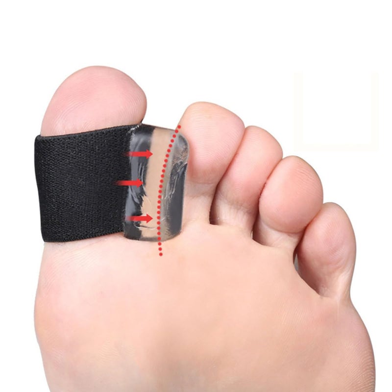 Large Black Toe Separators 4 Pairs Orthopedic Alignment Relief for Men and Women - Image 4