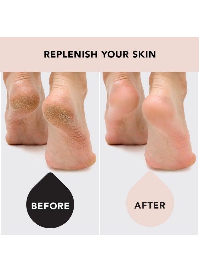 Kitsch - Moisturizing Socks For Cracked Heel Treatment, Insulated Gel Socks & Moisturizing Heel Socks For Dry Cracked Feet Women Men, Spa & Sleep Socks For Overnight Moisture Repair, 1 Reusable Pair - Image 1