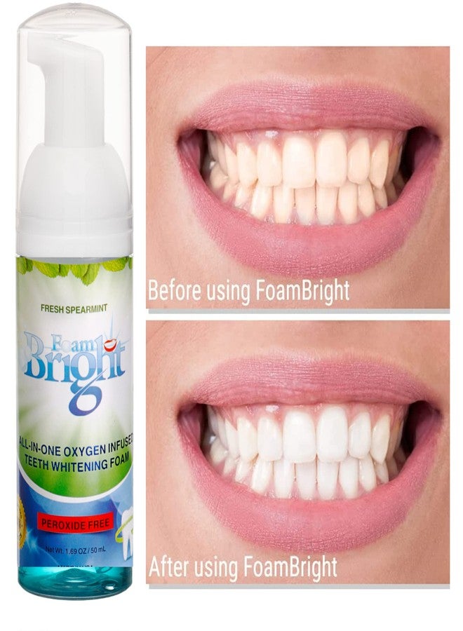 Bleachbright Retainer Cleaner & Aligner Cleaner FoamBright + Travel Retainer Case Kit | Great for Invisalign Aligners, Candid, Byte, Denture Cleaner | Whitens Teeth, Peroxide Free Oral Care | No Tablets Needed - Image 4