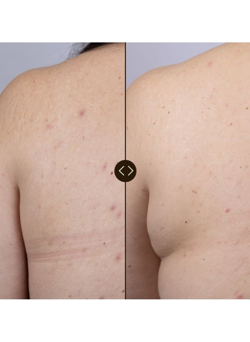 فريشلي سيروم الجسم النشط أزيليك فريشلي سريع الامتصاص 100 مل - Image 3