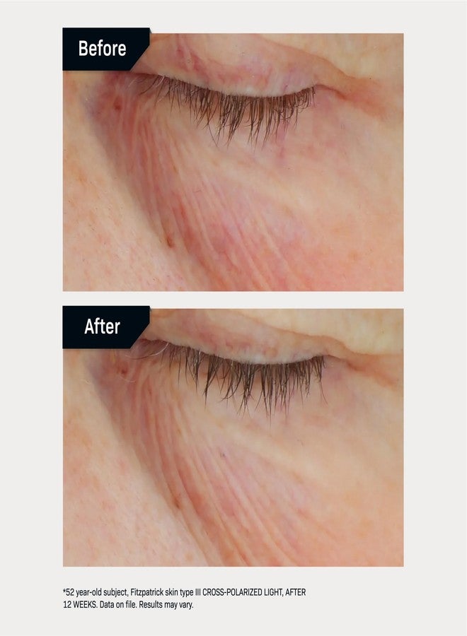 Revision Skincare C+ Brightening Eye Complex™ with Vitamin C and Antioxidants, Eye Cream for Dark Circles and Under Eye Puffiness, 0.25 oz - Image 5