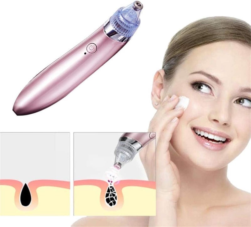 XN-8030 Vacuum Facial Pore Cleaner Blackhead Remover Negative Pressure Pore Cleaner Skin Care with 4 Interchangeable Heads, Rose - Image 1