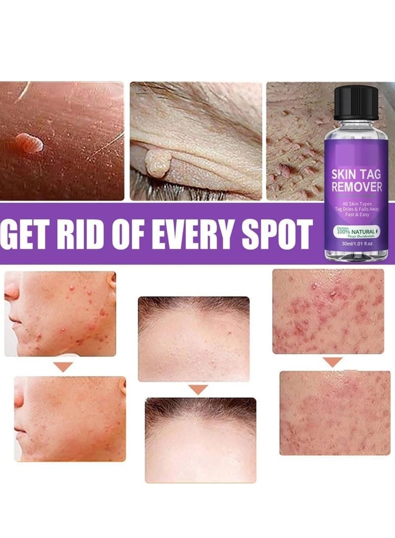 EELHOE Skin Tag Remover, Natural Wart and Mole Removal with Safe Ingredients – Effective Frozen Formula for Skin Renewal without Irritation, Easy to Use for Face and Body (30 ml) - Image 3