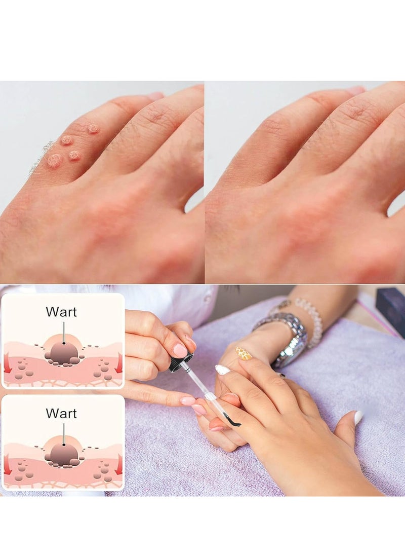 EELHOE Skin Tag Remover, Natural Wart and Mole Removal with Safe Ingredients – Effective Frozen Formula for Skin Renewal without Irritation, Easy to Use for Face and Body (30 ml) - Image 5