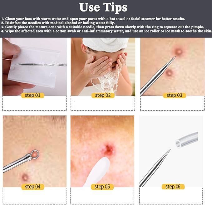 YMCCOOL Blackhead Remover Tool Kit12Pcs Pimple Popper Comedone Extractor Tool Kit for Quick and Easy Removal of PimplesBlackheads Zit on Face