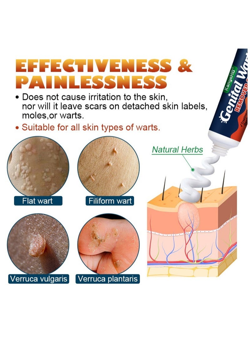 KanyeHB Wart Removal Cream,  Wart Remover for Genital Warts, Plantar Warts, Common Warts, Corns, Wart Cream 20g  - Image 2