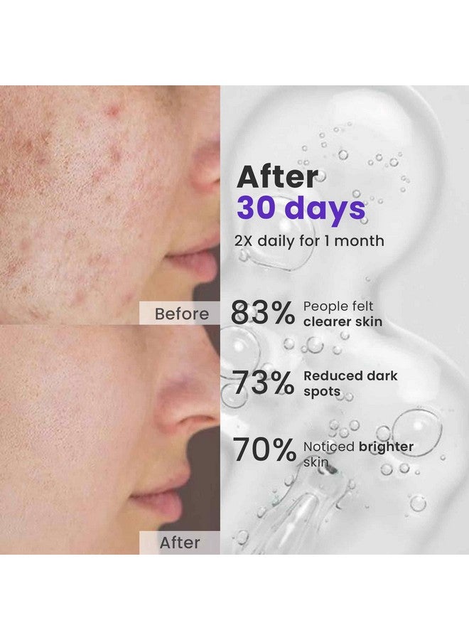 Saffr'n Face Spot Corrector with Saffron extract, 1% Kojic acid, for Face Spot and Blemish Reduction | 30 g - Image 3