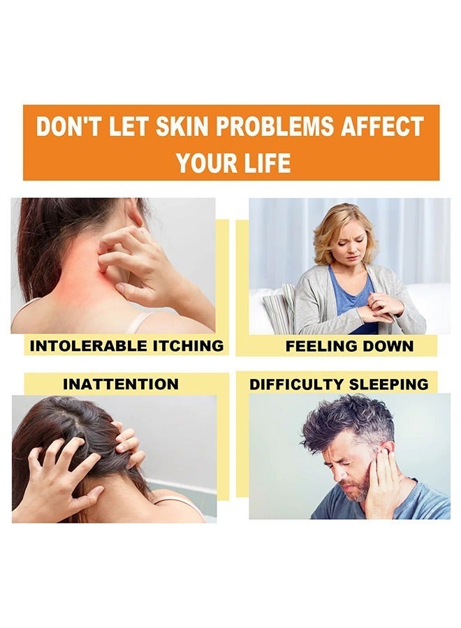 SOL LORA Bee venom psoriasis cream-Long Lasting Relieve Psorlasis Inhibit Fungal Infaction ,Natural Herbal Antibacterial Cream,for Body Itching 20G - Image 5