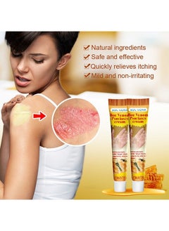 SOL LORA Bee venom psoriasis cream-Long Lasting Relieve Psorlasis Inhibit Fungal Infaction ,Natural Herbal Antibacterial Cream,for Body Itching 20G  - Image 4