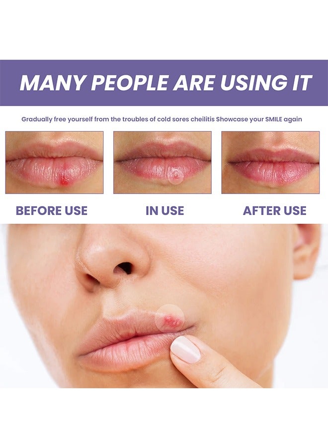 EELHOE 36 PCS Lip Care Healing Patch, Invisible Lip Acne Healing Hydrocolloid Patch, for Treating Dry, Chapped, or Damaged Lips, Soothes & Hides Cold Sores  - Image 4