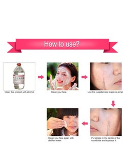 Generic 2-in-1 blackhead removal tool made of high-quality steel  - Image 5