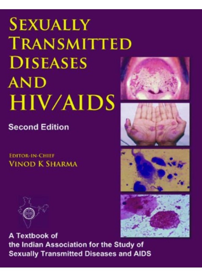 HIV/AIDS 
