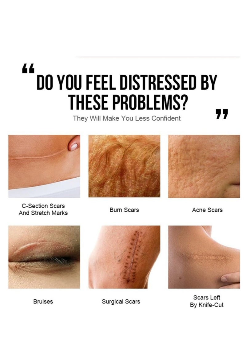 JoyPretty Shea Butter Intensive ,Scar Reducing Treatment, Intensive Repairing Scar Cream from Burns, Surgery 40g - Image 2