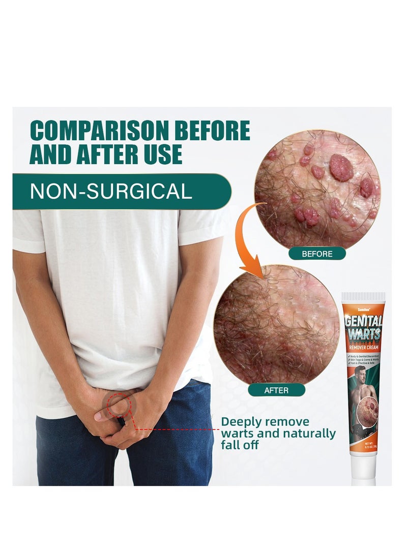 Sumifun Natural Wart Removal Cream – Gentle, Fast-Acting, and Skin-Friendly  - Image 3