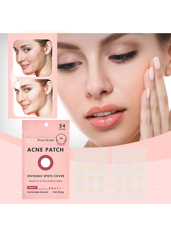 القمر الغربي رقعة حب الشباب غير المرئية من ويست مونث، غنية بالهيدرات والجلسرين وهيدروكسي إيثيل السليلوز ومستخلص جذر سنتيلا أسياتيكا وحمض الساليسيليك، مناسبة للتنظيف اللطيف لبشرة الوجه والتخلص من حب الشباب. - Image 2