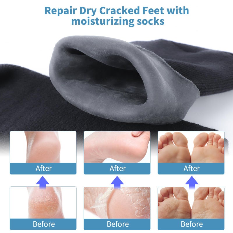 Aluroice 11" Large Silicone Moisturizing Socks for Men - 2 Pairs Soft Foot Care Socks - Feet Moisturizing Socks for Dry Cracked Feet (Size L) - Image 3