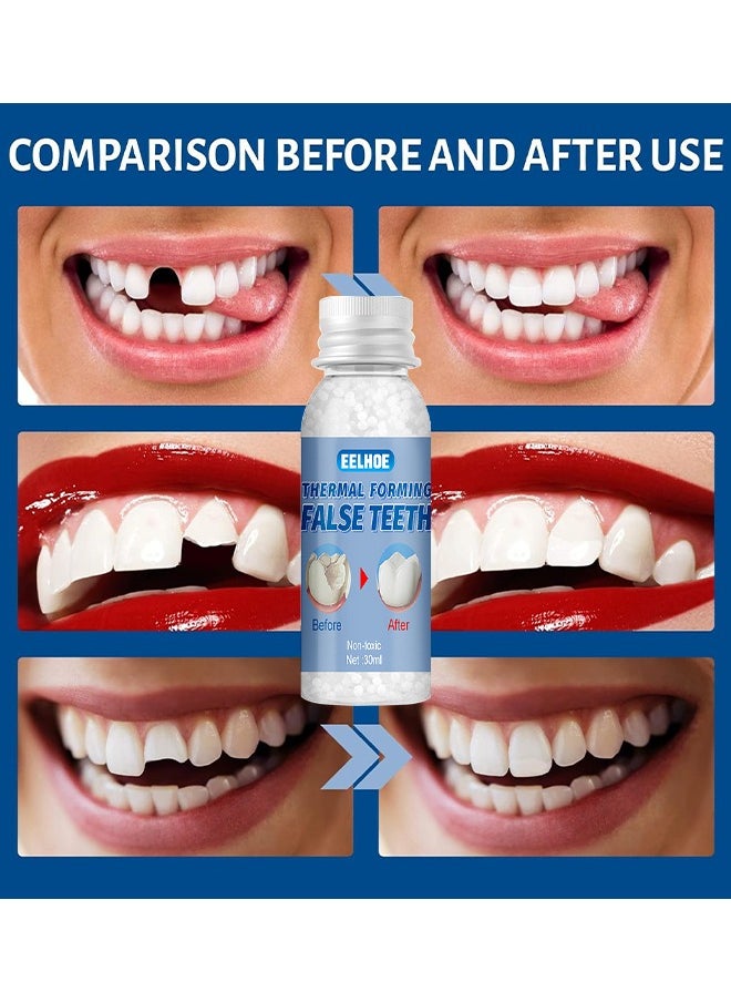 EELHOE - Temporary Tooth Repair Beads Tooth Repair Kit Teeth Filling Replacement For Chipped Teeth, Thermal Beads For Temporary Fix The Missing And Broken Tooth Fake Teeth 30ML - Image 1