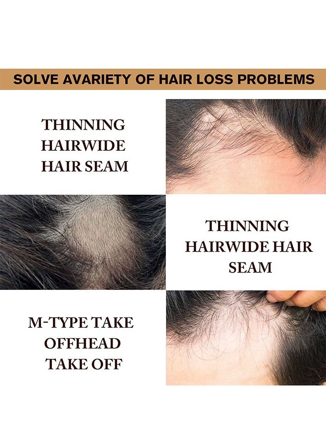 LUNOON Minoxidil Hair Growth Serum, 5% Minoxidil Hair Regrowth and Beard Growth, For Hair Loss Control & Hair Growth In Men & Women 60ml - Image 4