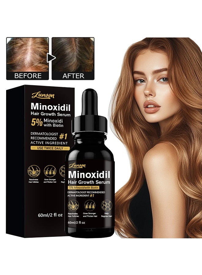 LUNOON Minoxidil Hair Growth Serum, 5% Minoxidil Hair Regrowth and Beard Growth, For Hair Loss Control & Hair Growth In Men & Women 60ml - Image 1
