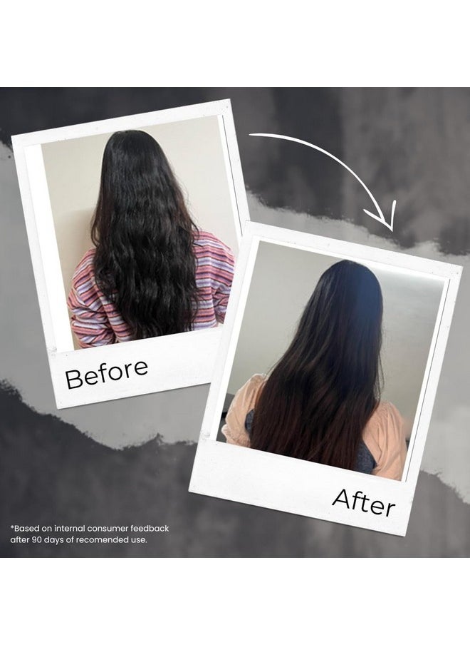 TRU HAIR & Skin Onion & Rosemary Hair Oil With Free Heater | Fights Hair Fall & Promotes Hair Growth -110 Ml | 100% Pure, Natural |  - Image 3
