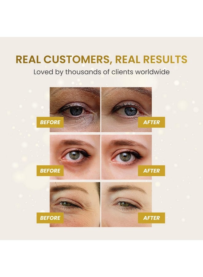 PLANTIFIQUE Gold Under Eye Patches for Puffy Eyes and Dark Circles 20 Pairs Under Eye Masks for Dark Circles and Puffiness Eye Gels with Collagen & Caffeine Anti Aging Gold Eye Mask Skincare - Image 4