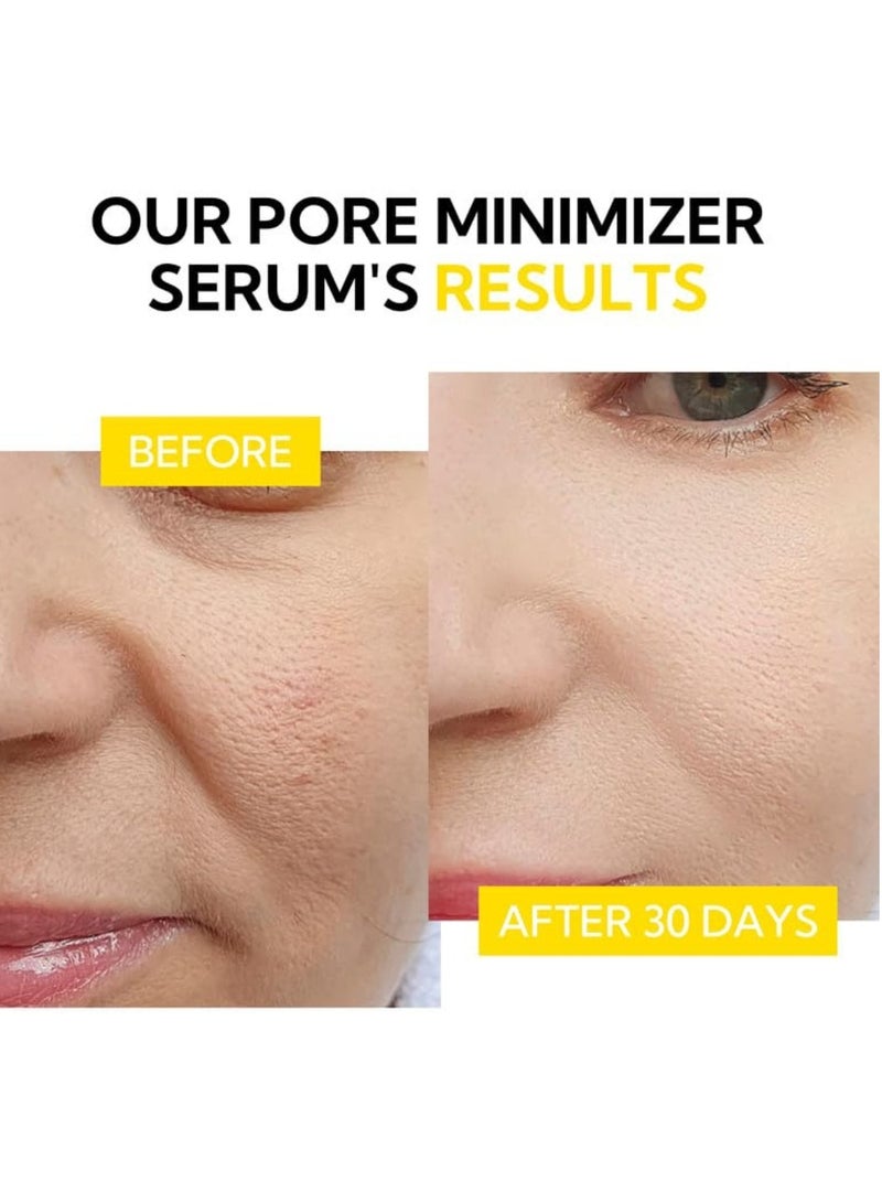 LANBENA سيروم حل المسام - سيروم تصغير المسام وتخفيفها لشد المسام وتقليل الزيوت 15 مل - Image 4