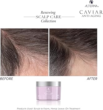 ALTERNA تجديد مقشر فروة الرأس سكرب إلى فوم 177 مل - Image 5