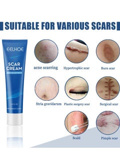 EELHOE Gel for Scars  - Image 3