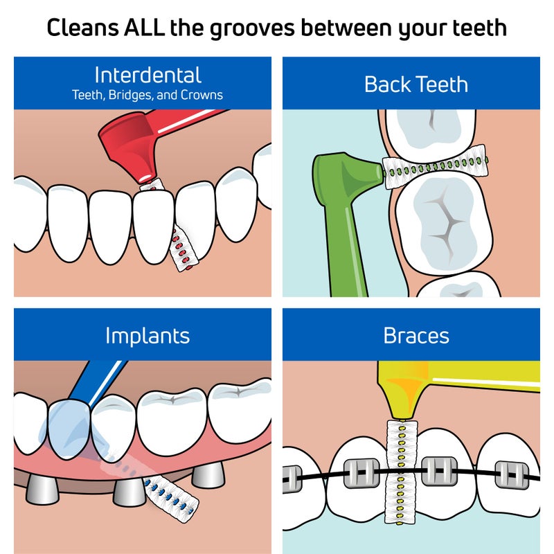 TePe Interdental Brush Angle, Angled Dental Brush for Teeth Cleaning, Pack of 25, 0.40 mm, Extra-Small/Small Gaps, Pink, Size 0 - Image 3