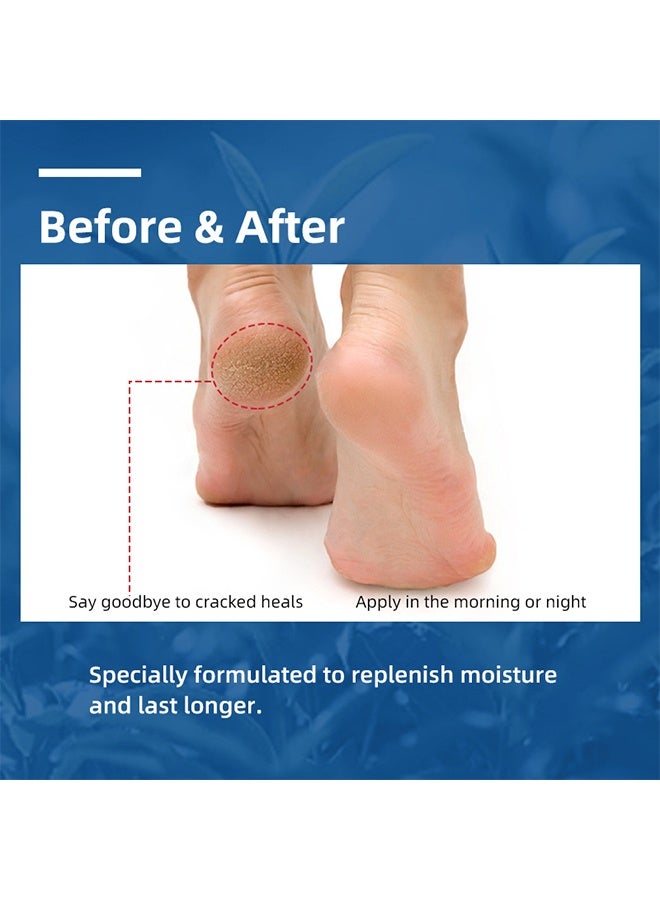 SUMAX 40% Urea Cream ，Foot Cream for Cracked Feet Hands 50g Callus Remover Hand Cream Foot Cream for Cracked Foot Heels Elbows Nails Knees Skin Moisturizer Urea Lotion with Maximum Strength for Men and Women - Image 3