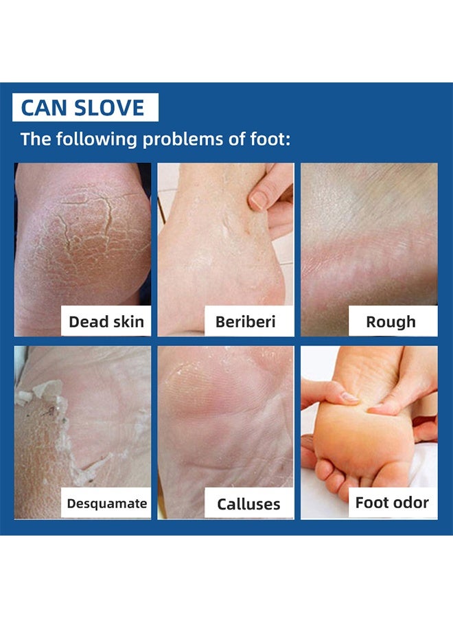 SUMAX 40% Urea Cream ，Foot Cream for Cracked Feet Hands 50g Callus Remover Hand Cream Foot Cream for Cracked Foot Heels Elbows Nails Knees Skin Moisturizer Urea Lotion with Maximum Strength for Men and Women - Image 4