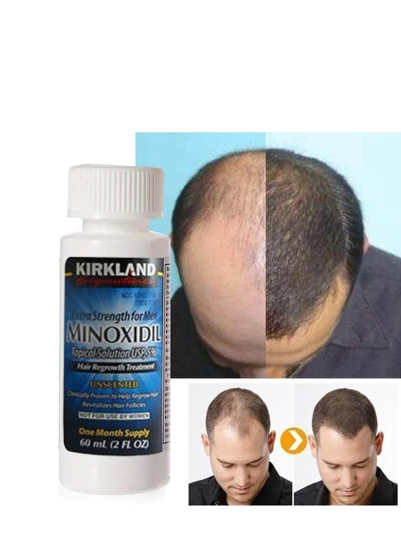 Kirkland Signature - 2-Piece Minoxidil 5% Extra Strength Hair Regrowth Treatment 60ml - Image 1