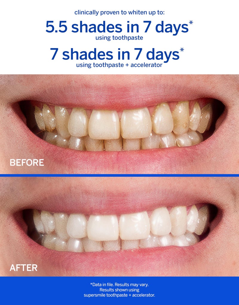 Supersmile Teeth Whitening System - Whitening Toothpaste and Accelerator - Whitens Up to 7 Shades - Image 3