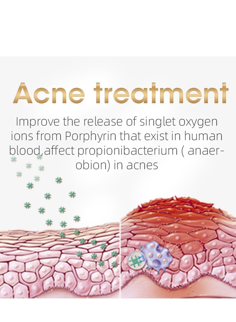 KinseiBeauty GP590 Plus Ice Cooling IPL Hair Removal Device With 3 Lamps(Hair removal/Skin Rejuvenation/Acne Treatment) White Free Gift Blackhead Remover Device - Image 3