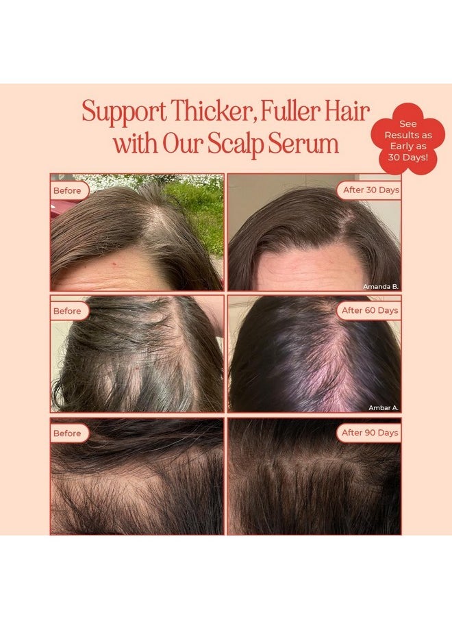 INH INH Hair Serum | G2G Biotin & Caffeine Scalp Treatment That Supports Natural Hair Growth | Non Comedogenic Follicle Stimulator & Multi-Peptide Serum for Hair Density & Strengthening | 30-Day Supply  - Image 2