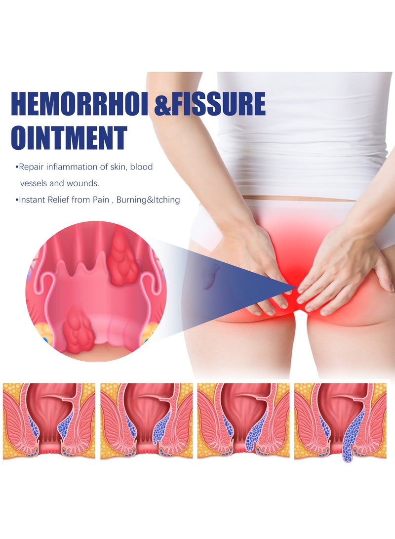 SOUTH MOON Doctor Hemorrhoid and Fissure Ointment Treatment with , Pure Aloe Vera, Amino Acids and Essential Oils and Minerals - Image 5