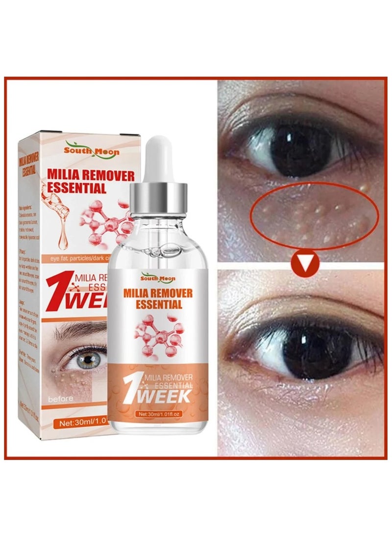 SOUTH MOON - Milia Remover Serum Anti Dark Circle Eye bags Fat Granules Deep Clean Liquid Anti-inflammatory Moisturizer Brighten Beauty Care - Image 1