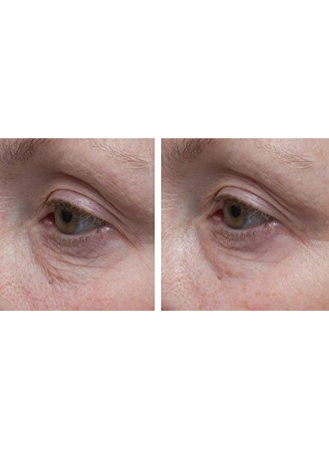 Dr. Denese Skinscience Firming Facial Collagen Eye Cream Face Moisturizer Hyaluronic Acid & Peptides Rejuvenate Skin - Improved Look Of Fine Lines, Elasticity, Sagginess, Bags - Cruelty-Free - 1Oz - Image 2