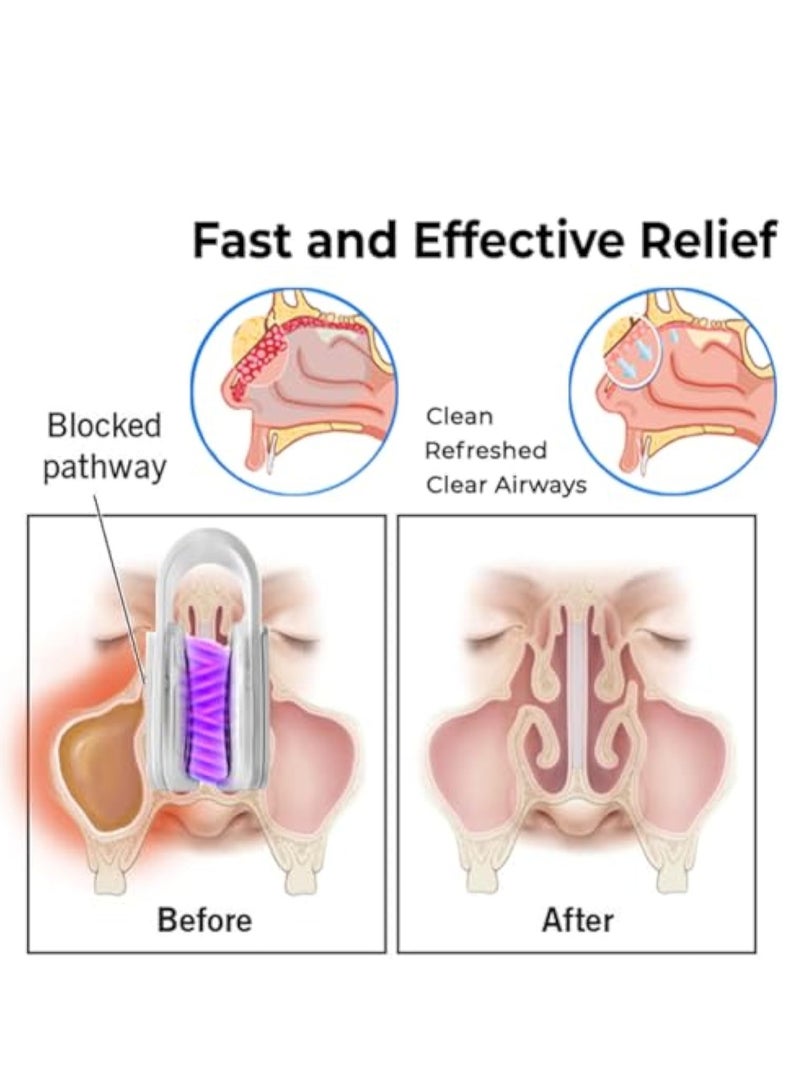 Nasal Mucus Cleaning Device, Nasal Wash u0026 Sinus Relief, Breathe Well Nasal Mucus Cleaning Device, Nasal Mucus Cleaning Device for Adults - Image 5