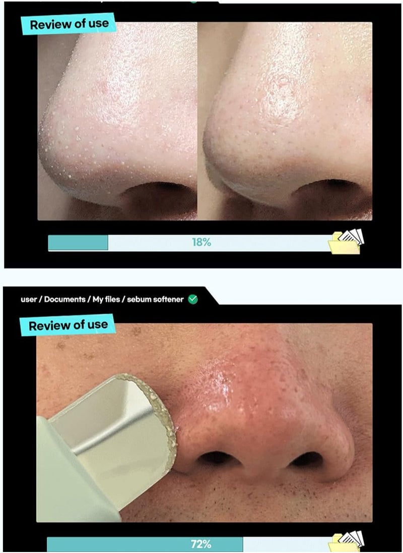 ilso - ILSO SUPER MELTING SEBUM SOFTENER - Image 1