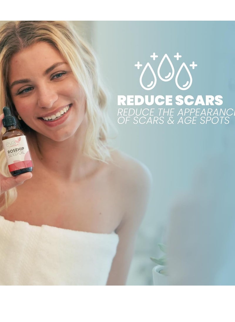 Eva Naturals Pure Rosehip Seed Oil (2 Fl Oz)- Rosehip Oil for Face Aids Stretch Mark and Scar Removal - Facial Oil Reduces Inflammation, Collagen for Radiant Skin - Face Oil - Best Rose Hip Oil for Face  - Image 3
