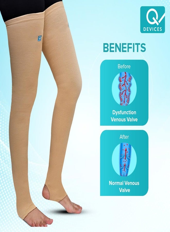 Q DEVICES Varicose Vein Stockings Above Knee (ABOVE KNEE, S) - Image 3