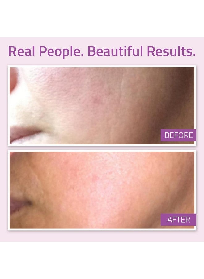 يوث سيروم YEOUTH المضاد للشيخوخة للوجه مع حمض الهيالورونيك وفيتاميني C وE وحمض الفيروليك، سيروم للوجه يستهدف البشرة الباهتة والجافة، سيروم مرطب 1 أونصة - Image 4