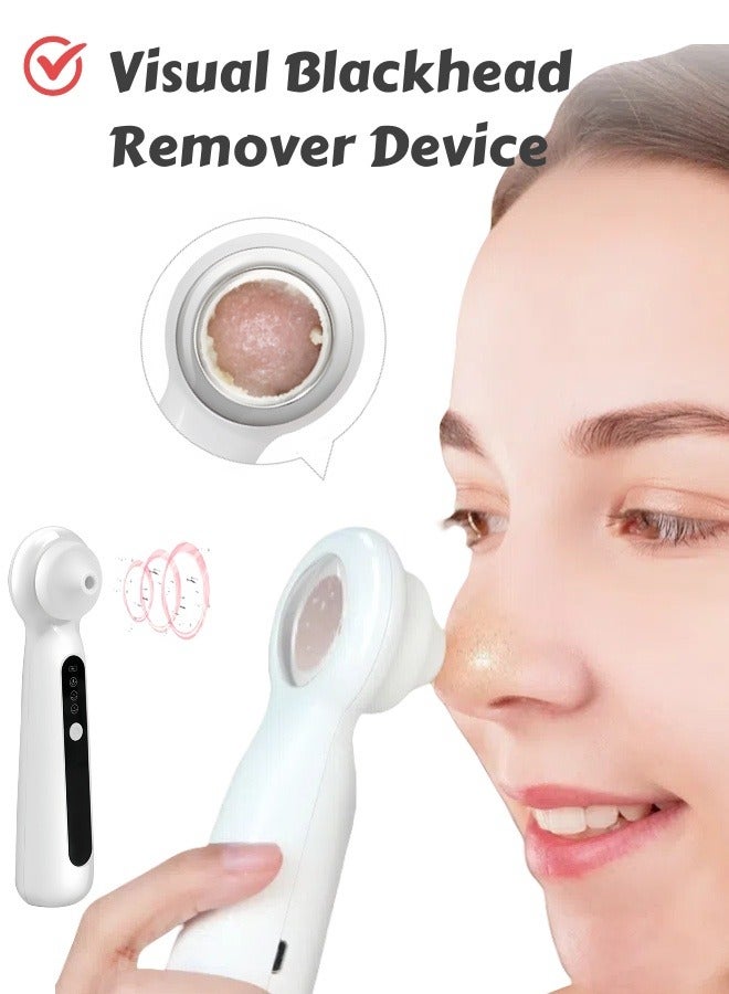 LAYRA Visible Blackhead Remover Vacuum Device USB Rechargeable Electric Pore Cleaner Beauty Tool for Home Use - Image 1
